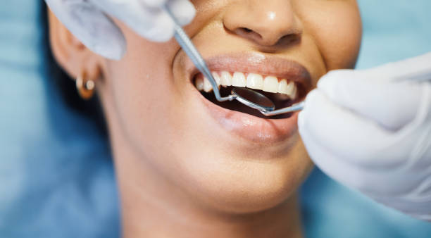 Best Emergency Treatment for Toothache in St Clairsville, OH